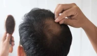 Diyet saç dökülmesi yapıyor