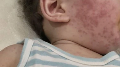 Bebek mamasından sonra oğlum bu hale geldi!