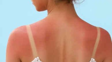 Dikkat; TikTok'taki bu akım kanser yapar! Tanmaxxing tehlikesi..