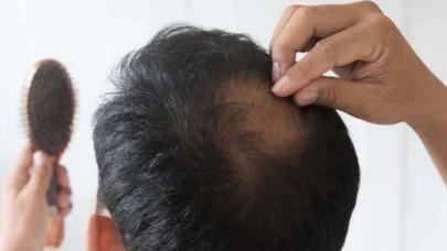 Kelliğe çözüm olacak bitki bulundu mu?