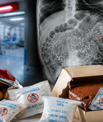 Çocuğun midesinde 'kum fırtınası' oluştu: Paketli gıdalardaki görünmez risk!