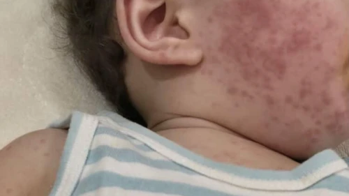 Bebek mamasından sonra oğlum bu hale geldi!